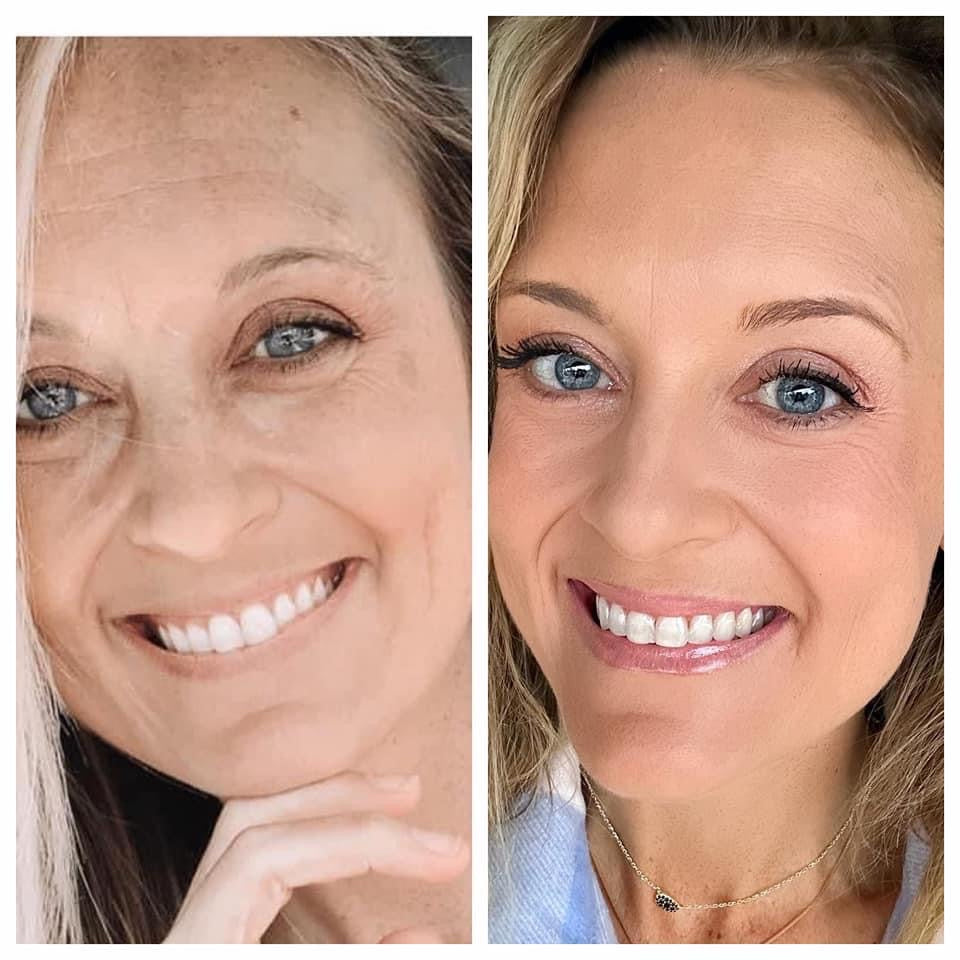 Lumi Spa iO -Rose Gold no cleanser