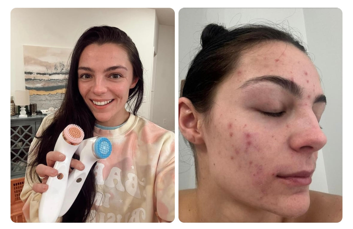 Lumi Spa iO -Rose Gold no cleanser