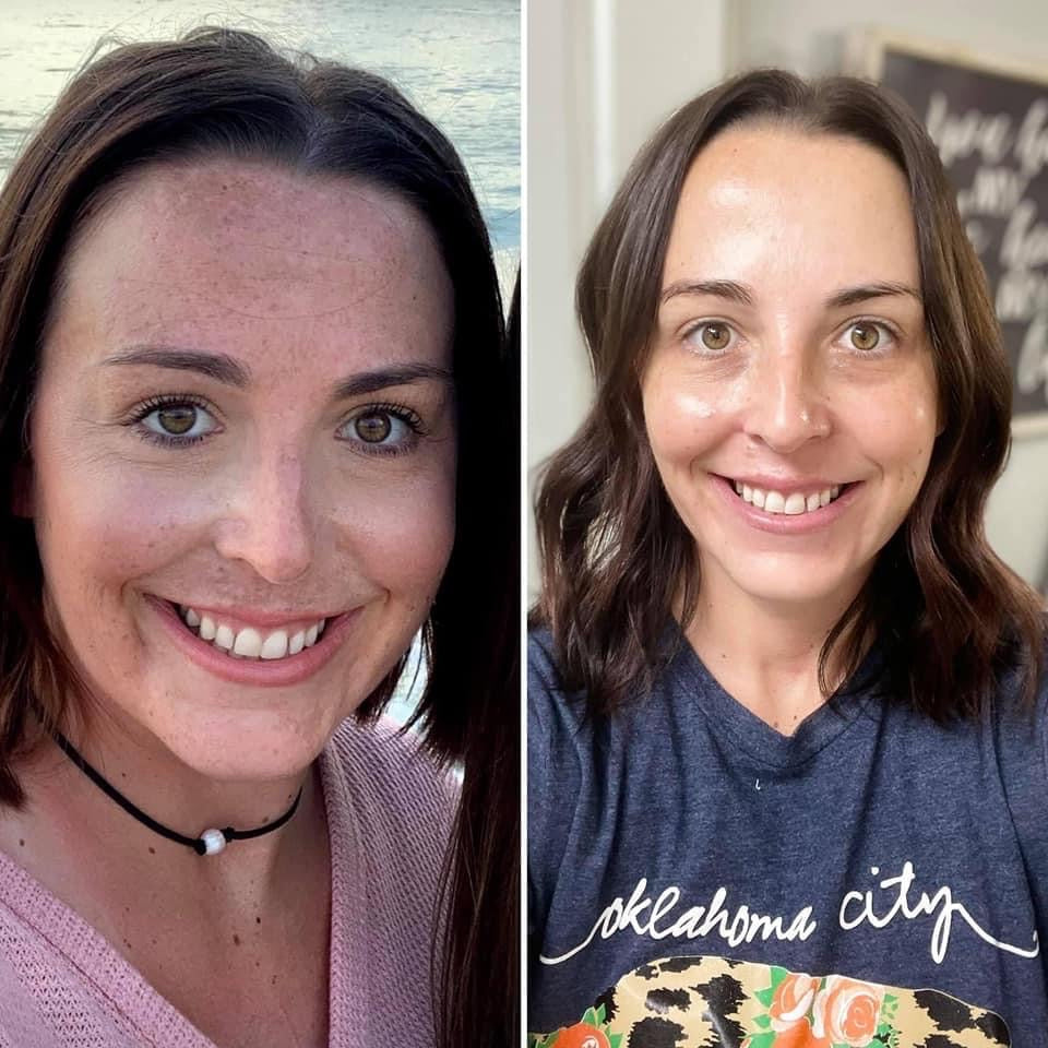 Lumi Spa iO -Rose Gold no cleanser