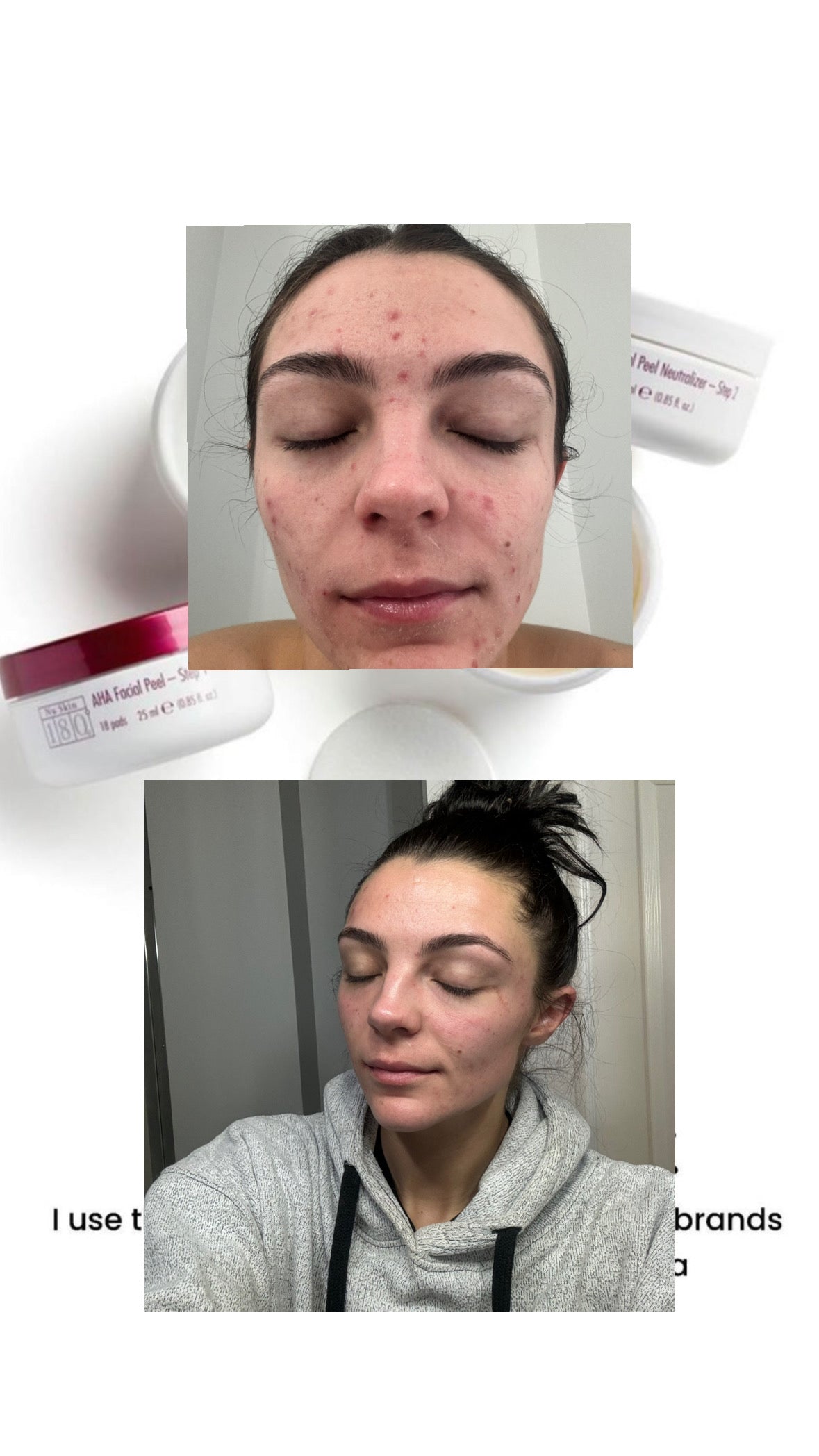 Sun Damage Bundle