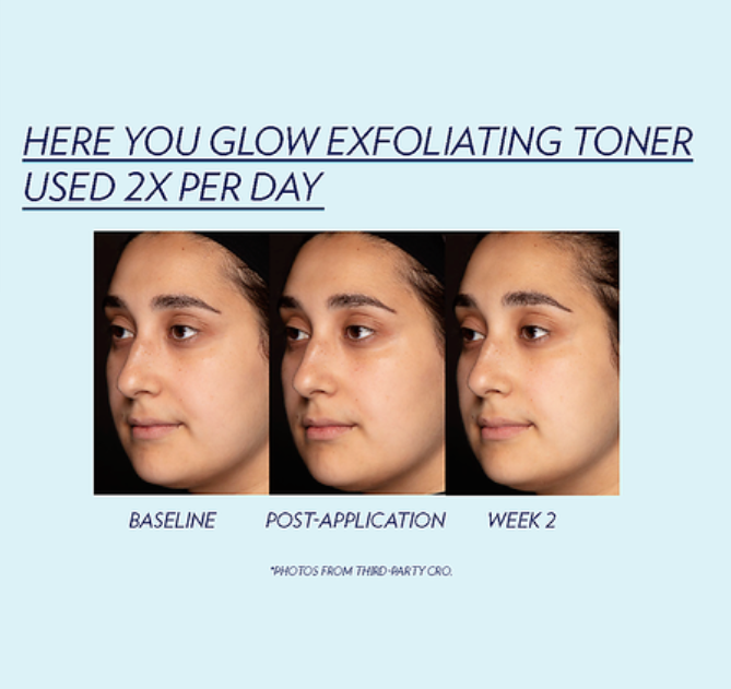 Exfoliating Toner